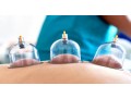 hijama-cupping-therapy-from-an-expert-therapist-small-0