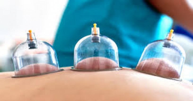 hijama-cupping-therapy-from-an-expert-therapist-big-0