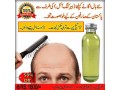 hair-king-oil-hair-growing-herbal-oil-small-0